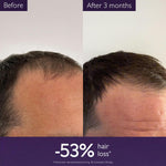 CAUDALIE Anti-Hair Loss Hair Serum