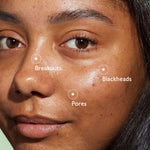 CAUDALIE Vinopure Blemish Control Salicylic Serum