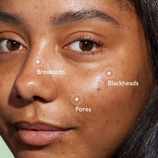 CAUDALIE Vinopure Blemish Control Salicylic Serum