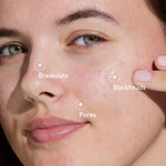 CAUDALIE Vinopure Blemish Control Salicylic Serum
