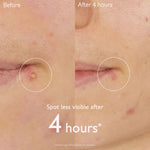 CAUDALIE Vinopure Salicylic Spot Solution