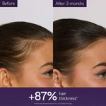 CAUDALIE Anti-Hair Loss Hair Serum