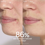 CAUDALIE Vinopure Blemish Control Salicylic Serum