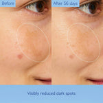 CAUDALIE Vinoperfect Concentrated Glycolic Essence