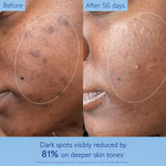 CAUDALIE Vinoperfect Brightening Dark Spot Serum