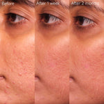 CAUDALIE Vinopure Blemish Control Salicylic Serum