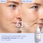 CAUDALIE Vinoperfect Brightening Dark Spot Serum 30ml