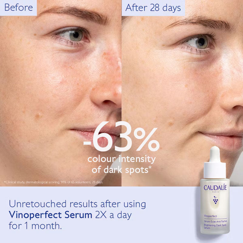 CAUDALIE Vinoperfect Brightening Dark Spot Serum 30ml
