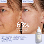CAUDALIE Vinoperfect Brightening Dark Spot Serum 30ml