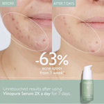 CAUDALIE Vinopure Blemish Control Salicylic Serum 30ml