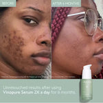 CAUDALIE Vinopure Blemish Control Salicylic Serum 30ml