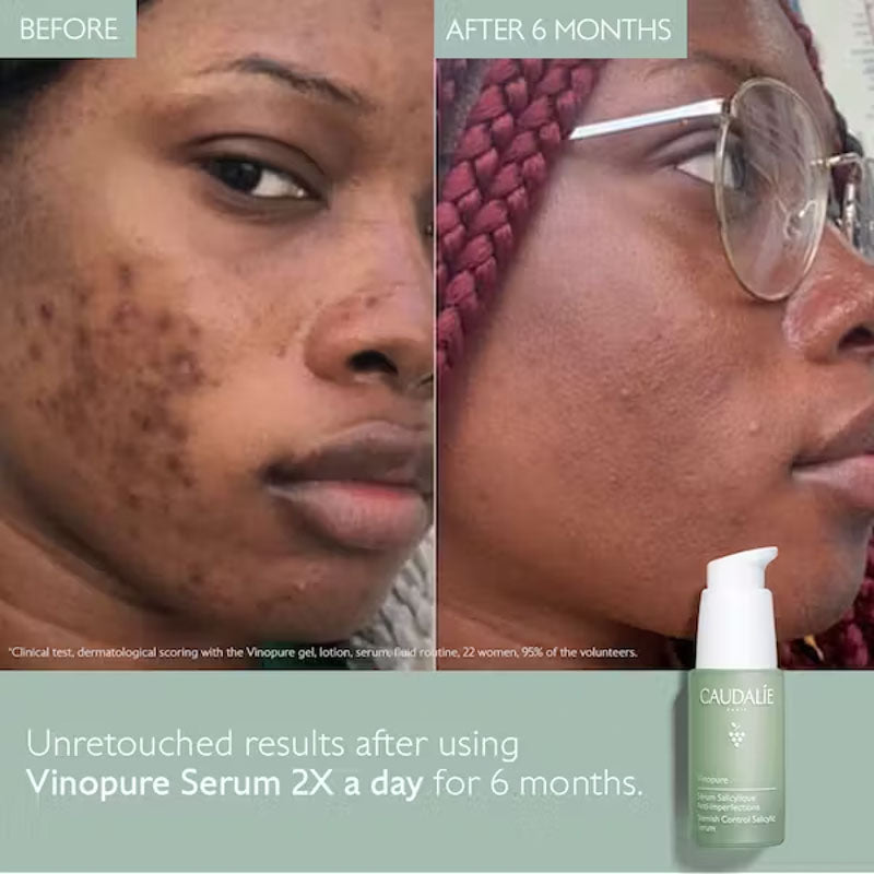 CAUDALIE Vinopure Blemish Control Salicylic Serum 30ml