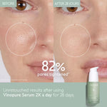 CAUDALIE Vinopure Blemish Control Salicylic Serum 30ml