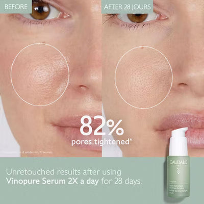 CAUDALIE Vinopure Blemish Control Salicylic Serum 30ml